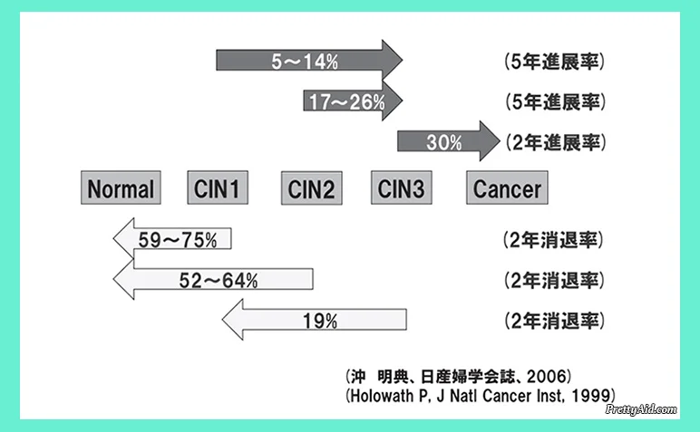 [８]CIN-1からCIN-2へ進行する確率[高度異形成]